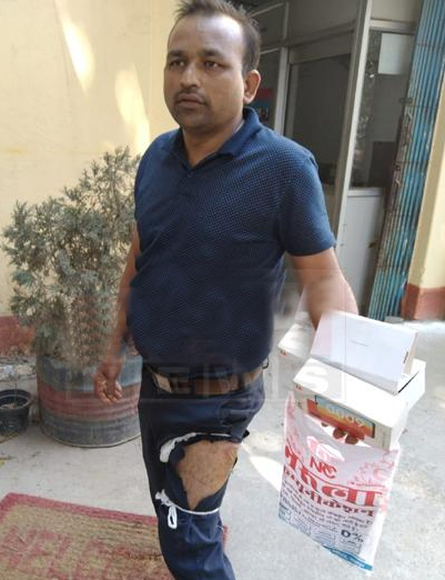 जेब में रखा मोबाइल अचानक फटा, युवक का पैर झुलसा