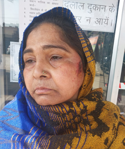 नशेड़ी पुत्र ने मां को पीटकर किया लहूलुहान