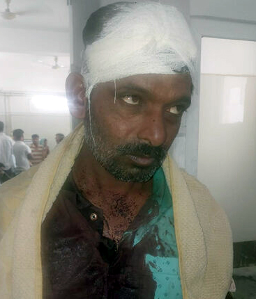 मिट्टी अवैध खनन का विरोध कर रहे ग्रामीणों पर दबंगों ने किया हमला एक ग्रामीण गंभीर रूप से घायल, कुछ को आईं मामूली चोटें