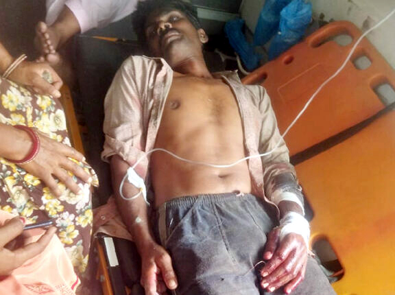 खेत में काम कर रहे किसान पर बोला जानलेवा हमला डॉक्टरों हालत गंभीर देखते हुए हायर सेंटर रेफर कर दिया  